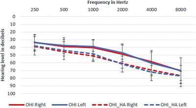Speech Perception in Older Adults: An Interplay of Hearing, Cognition, and Learning?